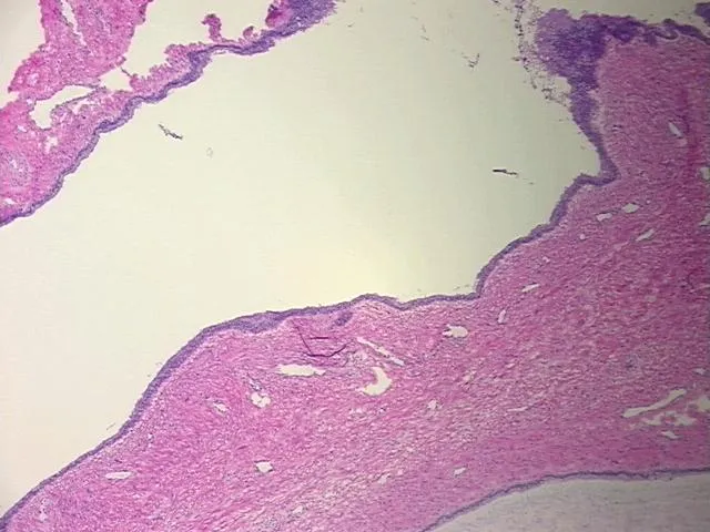 Frozen Tissue Sections, Cervix - image 1