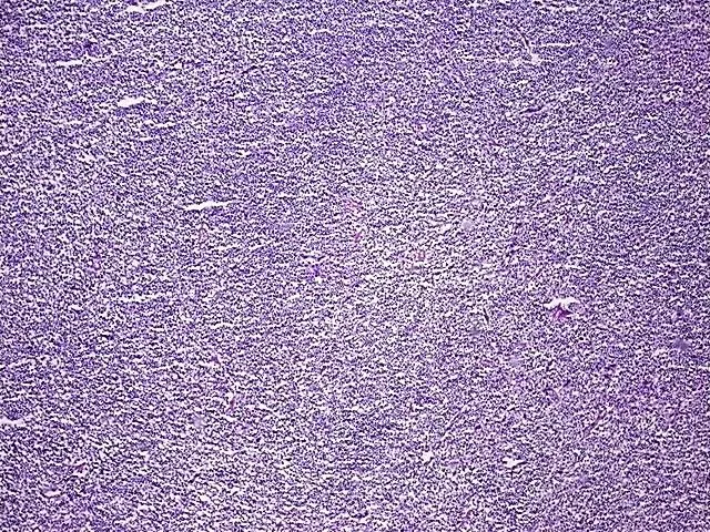 Frozen Tissue Sections, Lymph node - image 1