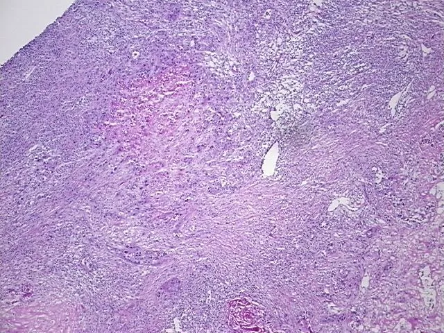 Frozen Tissue Sections, Urinary bladder - image 1