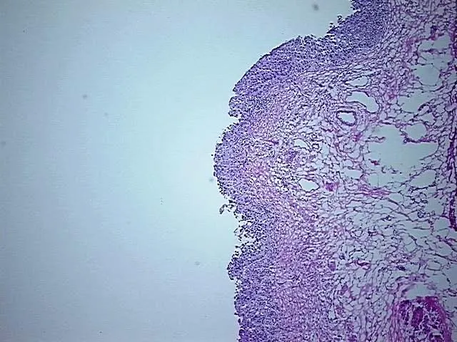 Frozen Tissue Sections, Urinary bladder - image 1