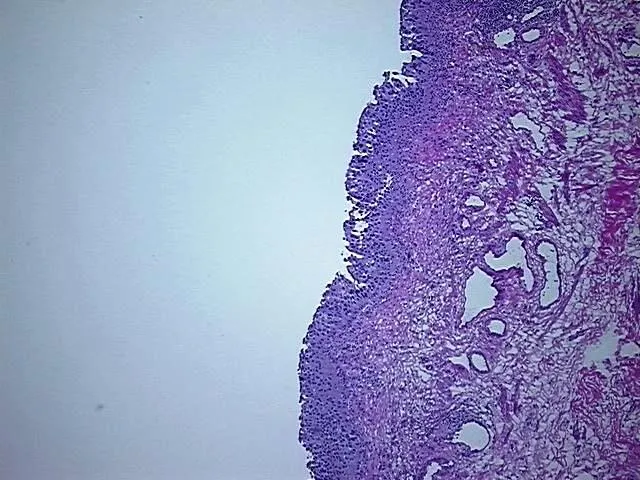 Frozen Tissue Sections, Urinary bladder - image 1