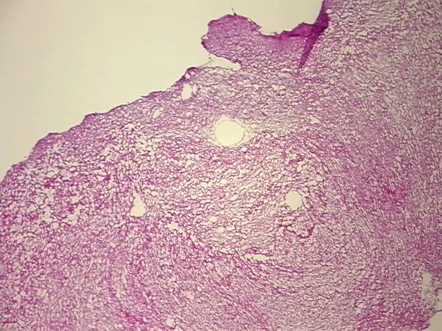 Frozen Tissue Sections, Aorta - image 1