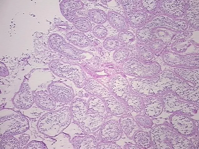 Frozen Tissue Sections, Testis - image 1