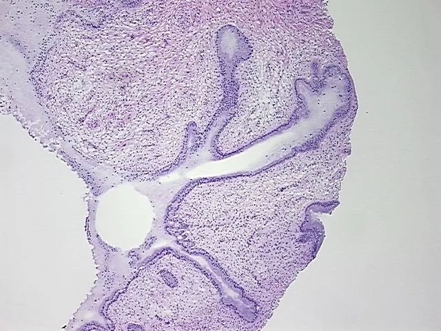 Frozen Tissue Sections, Cervix - image 1