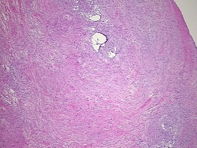 Frozen Tissue Sections, Brain - image 1