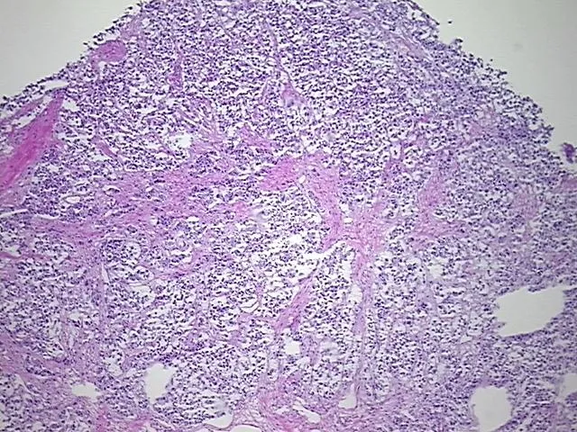 Frozen Tissue Sections, Multiple digestive system sites - image 1