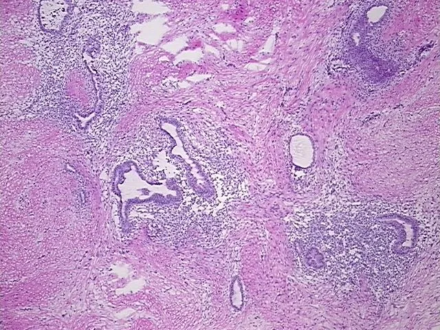 Frozen Tissue Sections, Endometriotic tissue - image 1