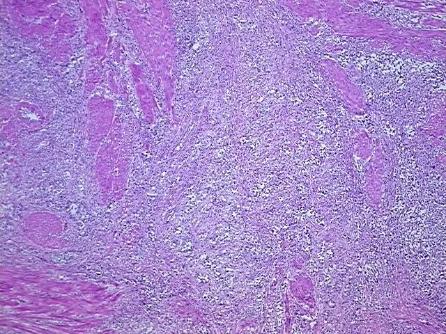Frozen Tissue Sections, Urinary bladder - image 1