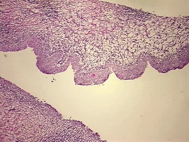 Frozen Tissue Sections, Urinary bladder - image 1