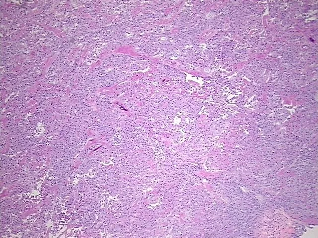 Frozen Tissue Sections, Brain - image 1