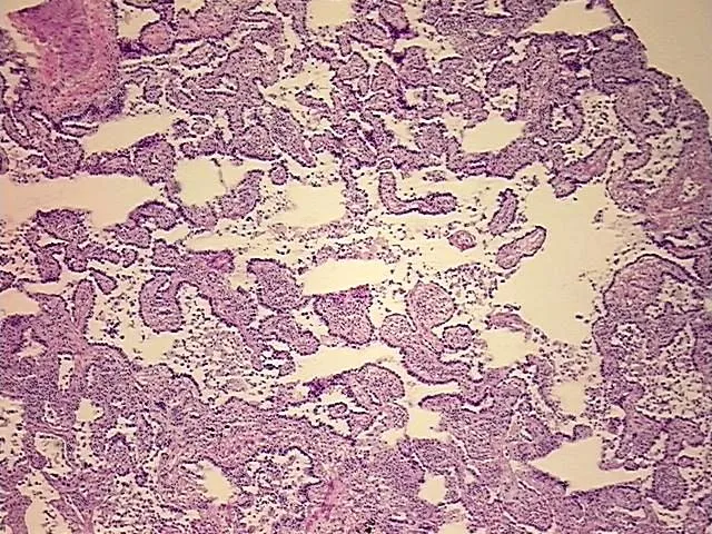 Frozen Tissue Sections, Lung: right lower lobe - image 1