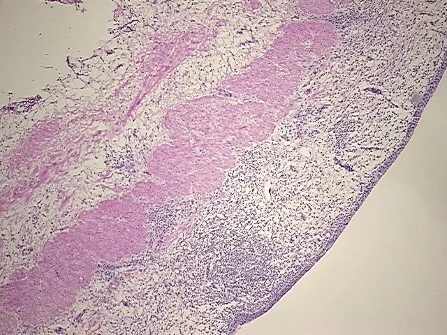 Frozen Tissue Sections, Ureter - image 1