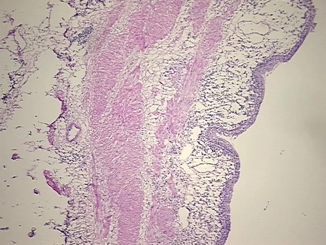 Frozen Tissue Sections, Ureter - image 1