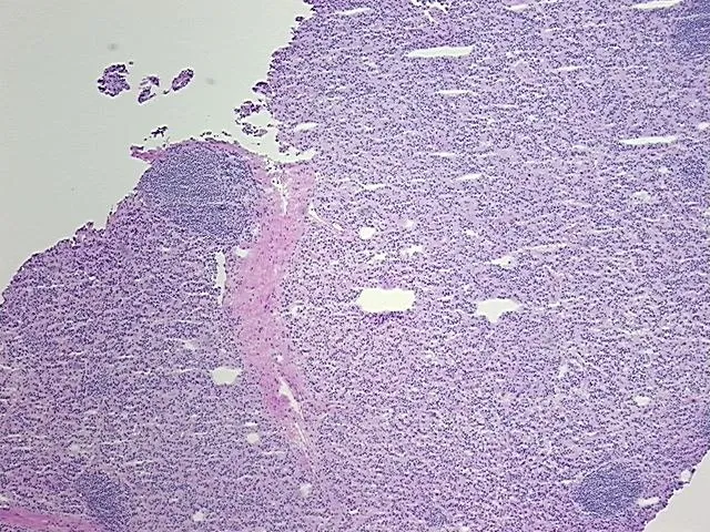 Frozen Tissue Sections, Duodenum - image 1