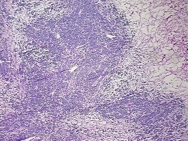 Frozen Tissue Sections, Lymphoid tissue - image 1