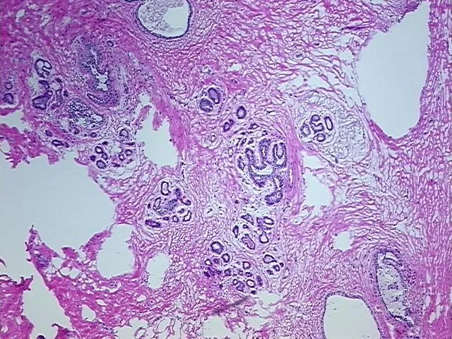 Frozen Tissue Sections, Breast - image 1