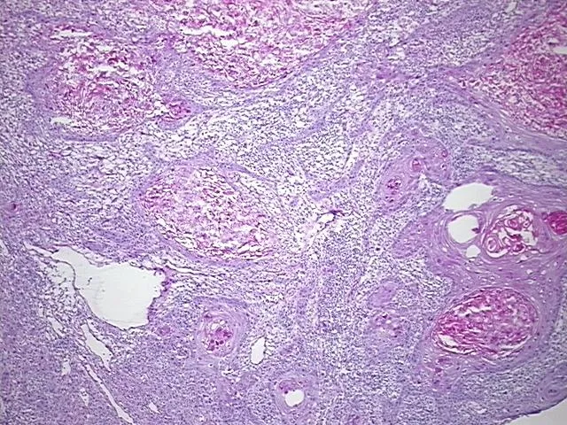 Frozen Tissue Sections, Skin - image 1