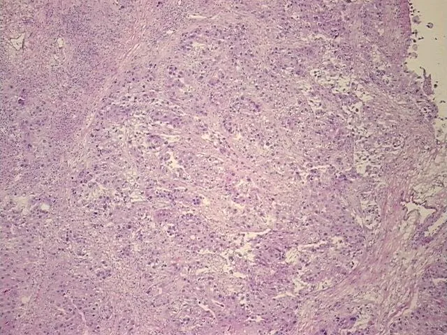 Frozen Tissue Sections, Breast - image 1