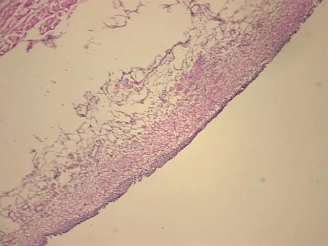 Frozen Tissue Sections, Urinary bladder - image 1