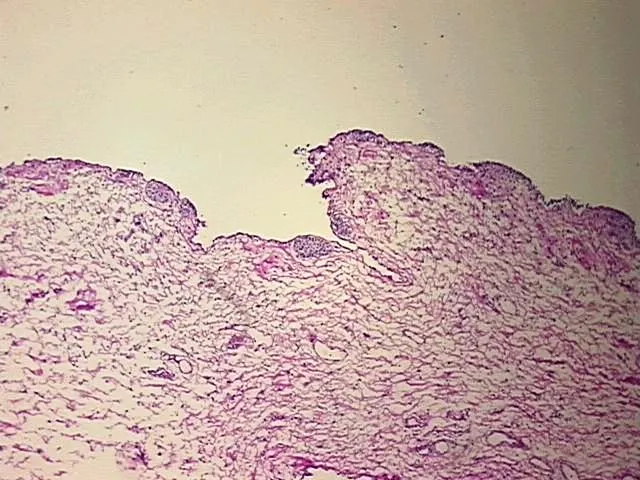 Frozen Tissue Sections, Urinary bladder - image 1