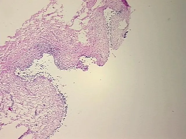 Frozen Tissue Sections, Urinary bladder - image 1