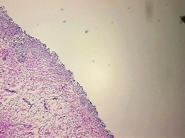 Frozen Tissue Sections, Urinary bladder - image 1