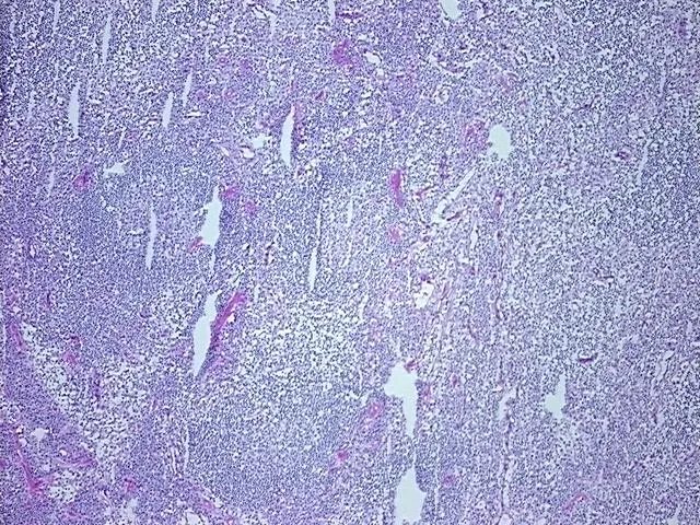 Frozen Tissue Sections, Lymph node - image 1