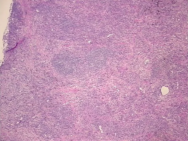 Frozen Tissue Sections, Lung - image 1