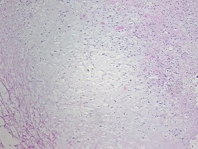 Frozen Tissue Sections, Bone - image 1