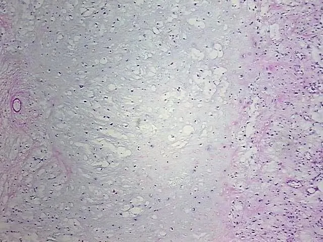 Frozen Tissue Sections, Bone - image 1