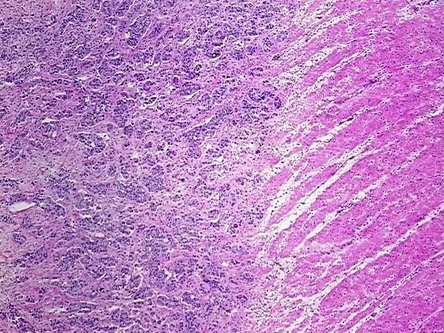 Frozen Tissue Sections, Rectum - image 1