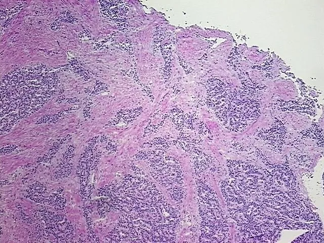 Frozen Tissue Sections, Duodenum - image 1