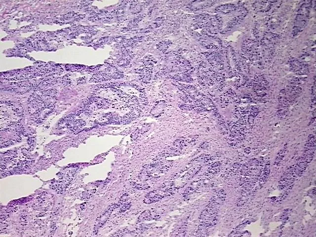 Frozen Tissue Sections, Rectum - image 1