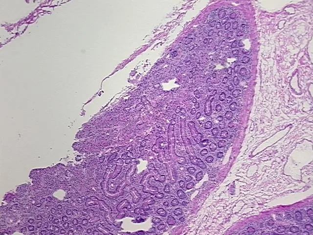 Frozen Tissue Sections, Duodenum - image 1