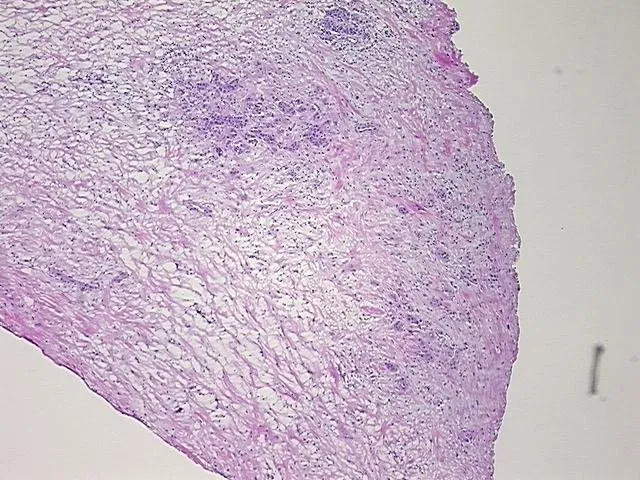 Frozen Tissue Sections, Small intestine - image 1