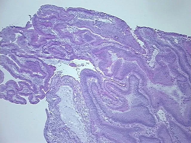 Frozen Tissue Sections, Rectum - image 1