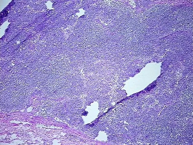 Frozen Tissue Sections, Lymph node - image 1