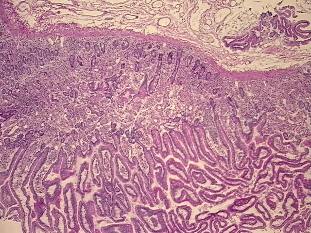 Frozen Tissue Sections, Duodenum - image 1