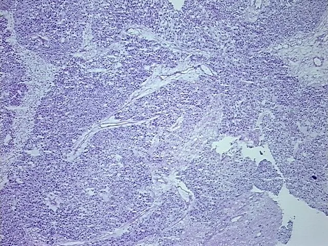 Frozen Tissue Sections, Urinary bladder - image 1