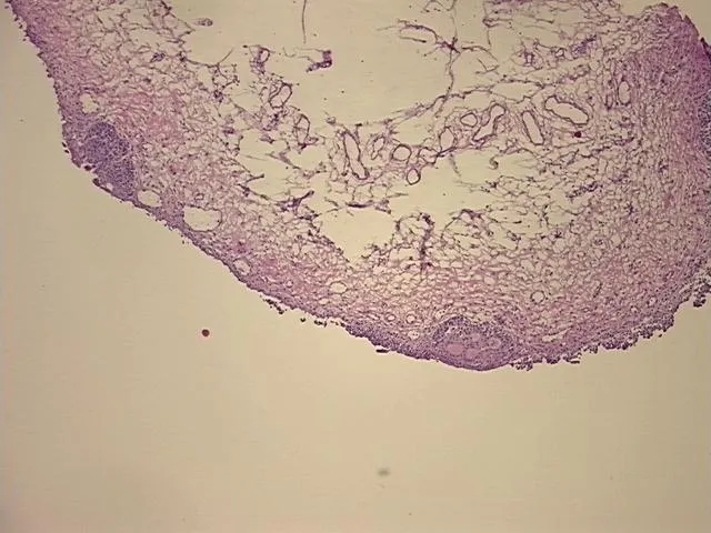 Frozen Tissue Sections, Urinary bladder - image 1