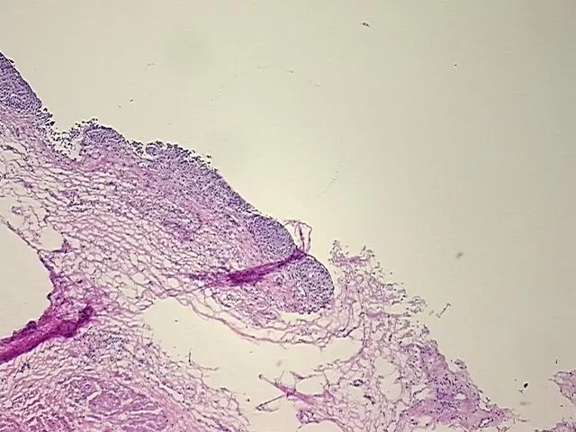 Frozen Tissue Sections, Urinary bladder - image 1