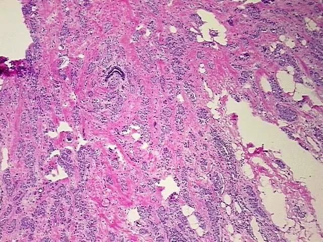 Frozen Tissue Sections, Breast, right medial - image 1