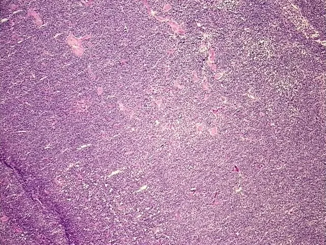 Frozen Tissue Sections, Lymphoid tissue - image 1