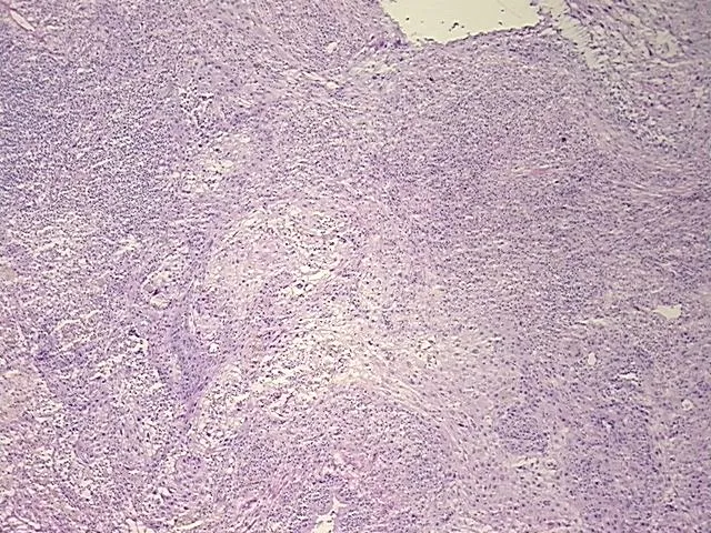 Frozen Tissue Sections, Lung: right lower lobe - image 1