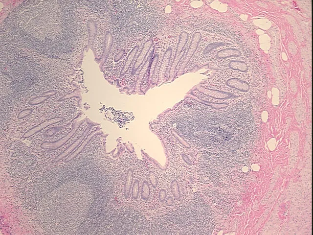 Tissue FFPE Sections, Appendix - image 1