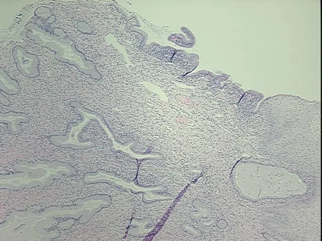 Tissue FFPE Sections, Cervix - image 1