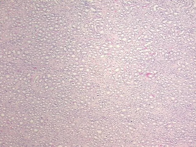 Tissue FFPE Sections, Kidney - image 1