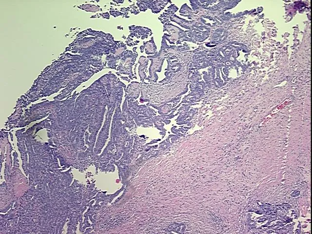 Tissue FFPE Sections, Ovary - image 1