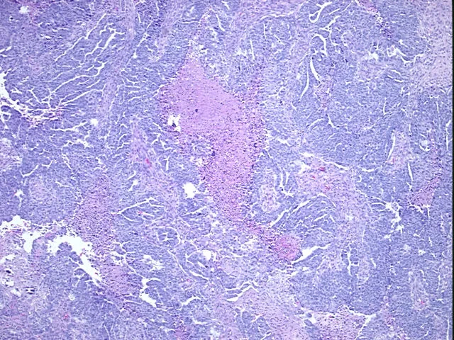 Tissue FFPE Sections, Ovary - image 1