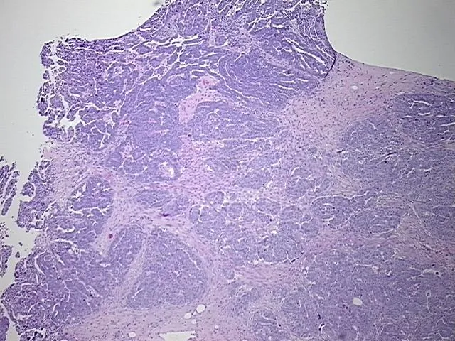 Tissue FFPE Sections, Ovary - image 1